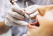 Фото - Стоматолог рассказала, как сэкономить на лечении зубов